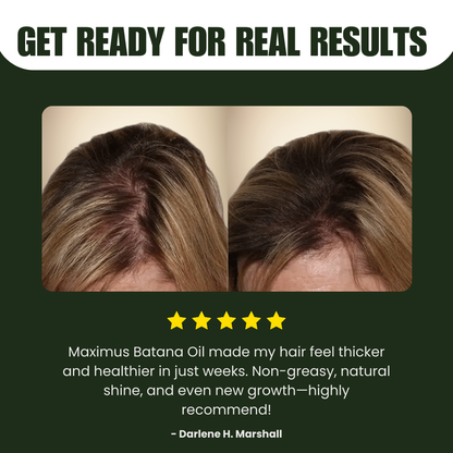 Maximus Batana Oil - Guaranteed Hair Growth from the Roots with Just 4 Applications a Week